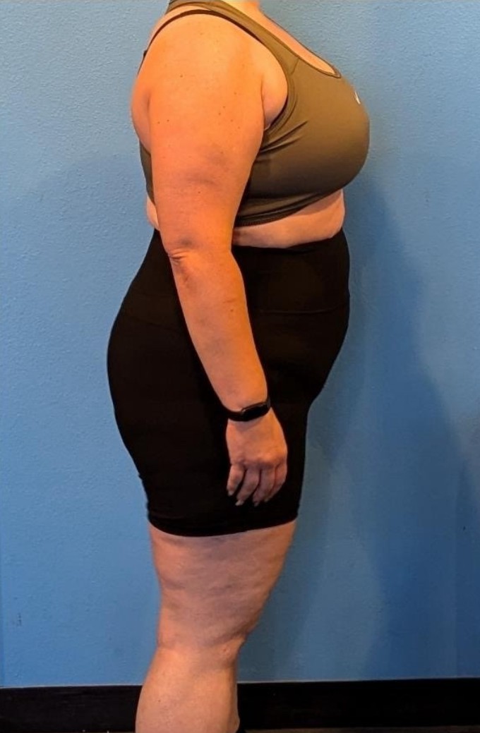 ATP client fat-loss transformation — after